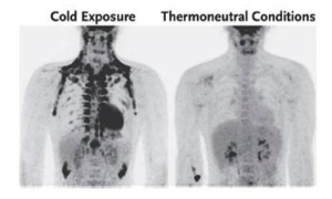 Brown fat distribution during cold exposure