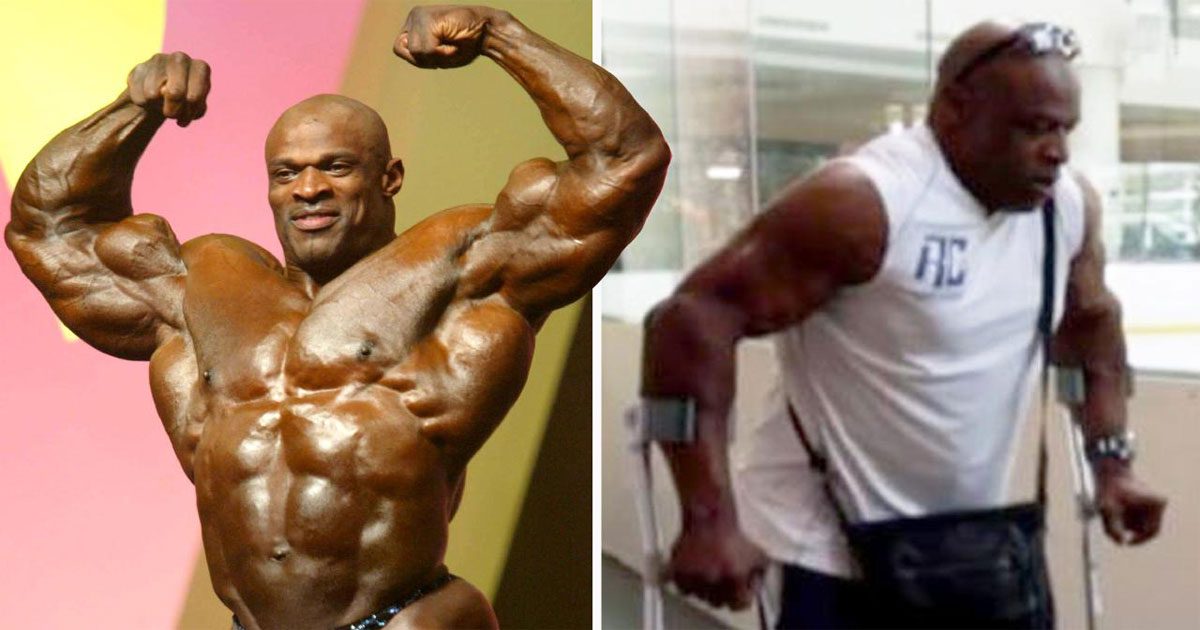 Bodybuilding Legend Crippled